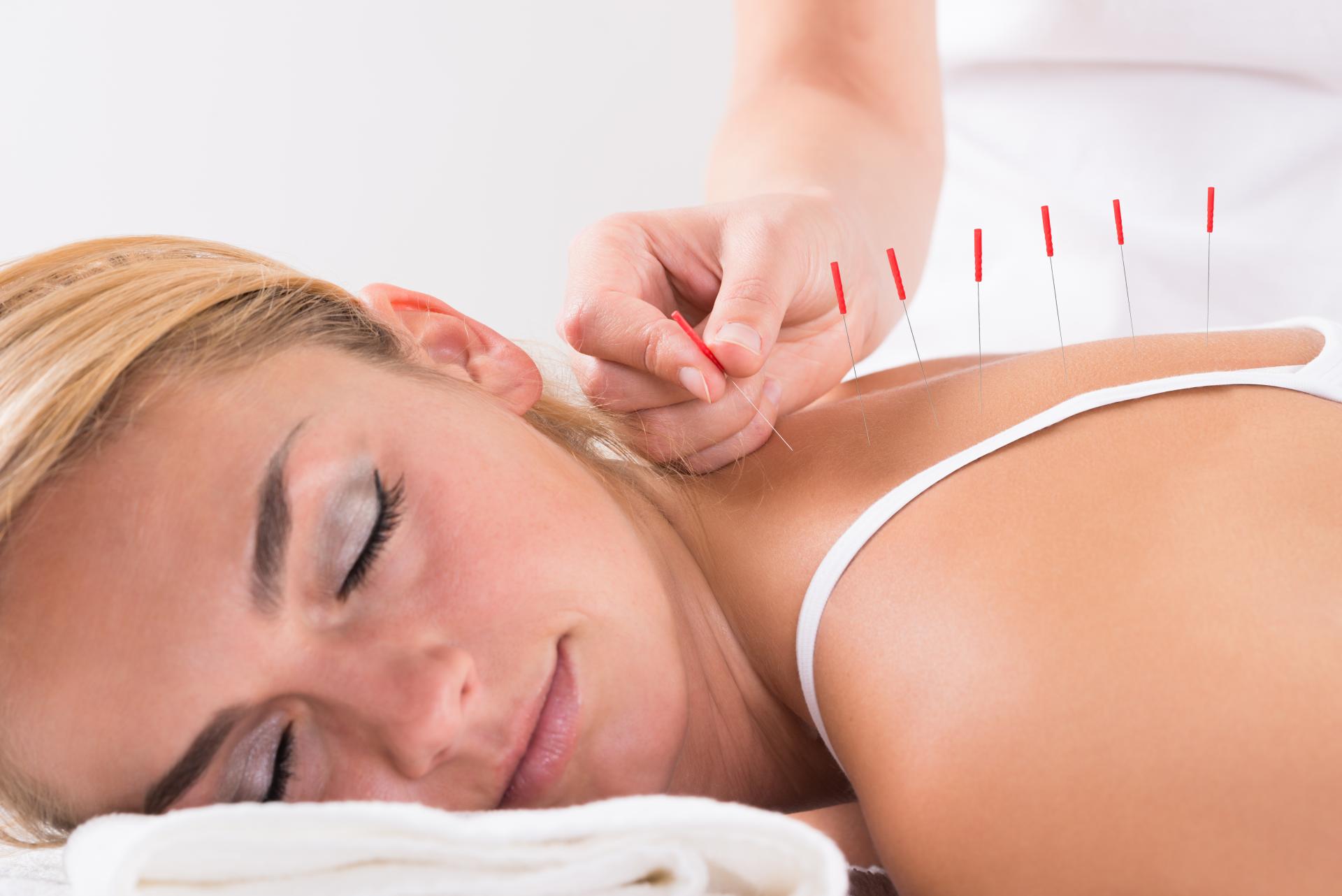 Terapias alternativas en Mallorca en el centro Kikai Acupuntura Mallorca