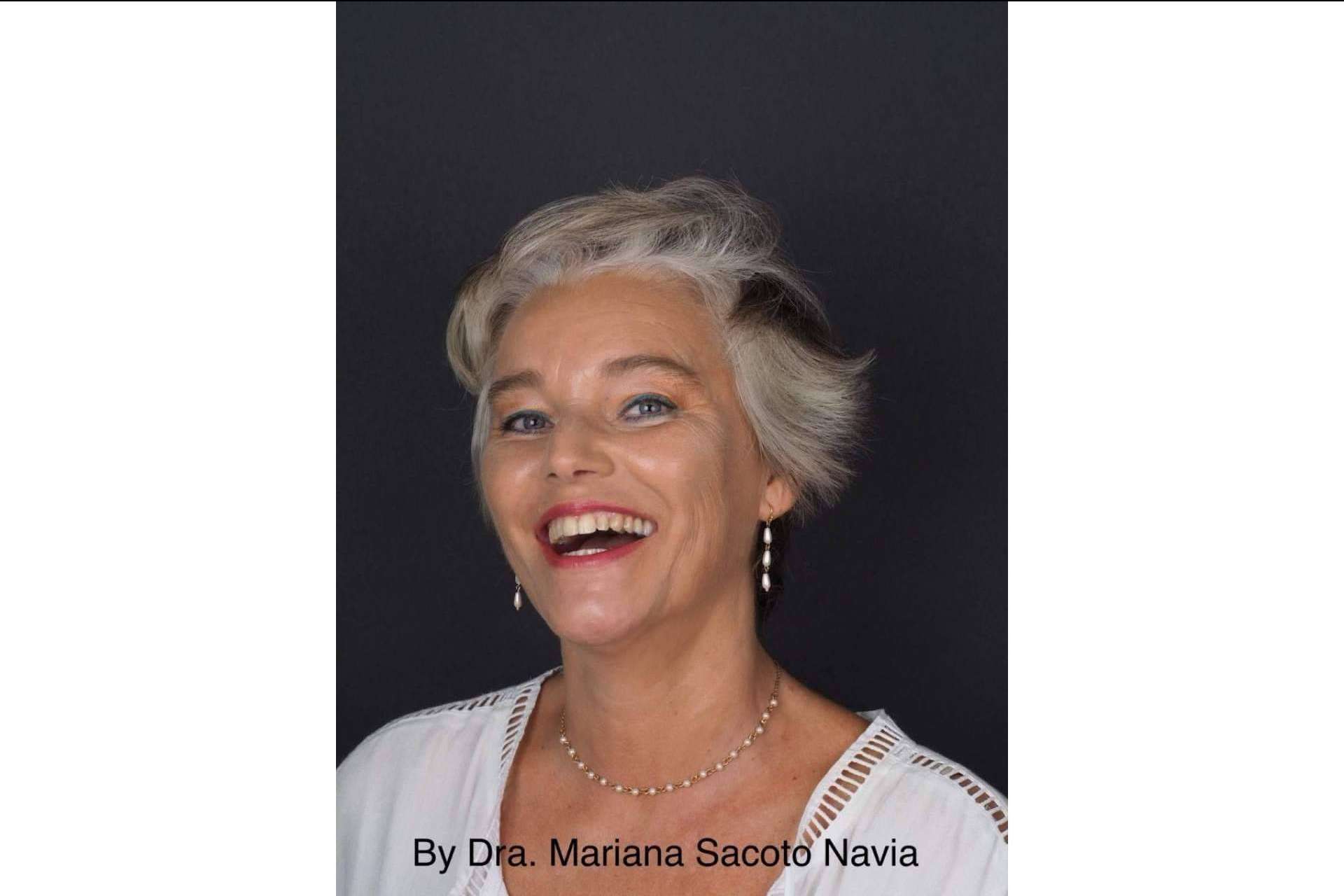Invisalign®, la ortodoncia para diseñar sonrisas