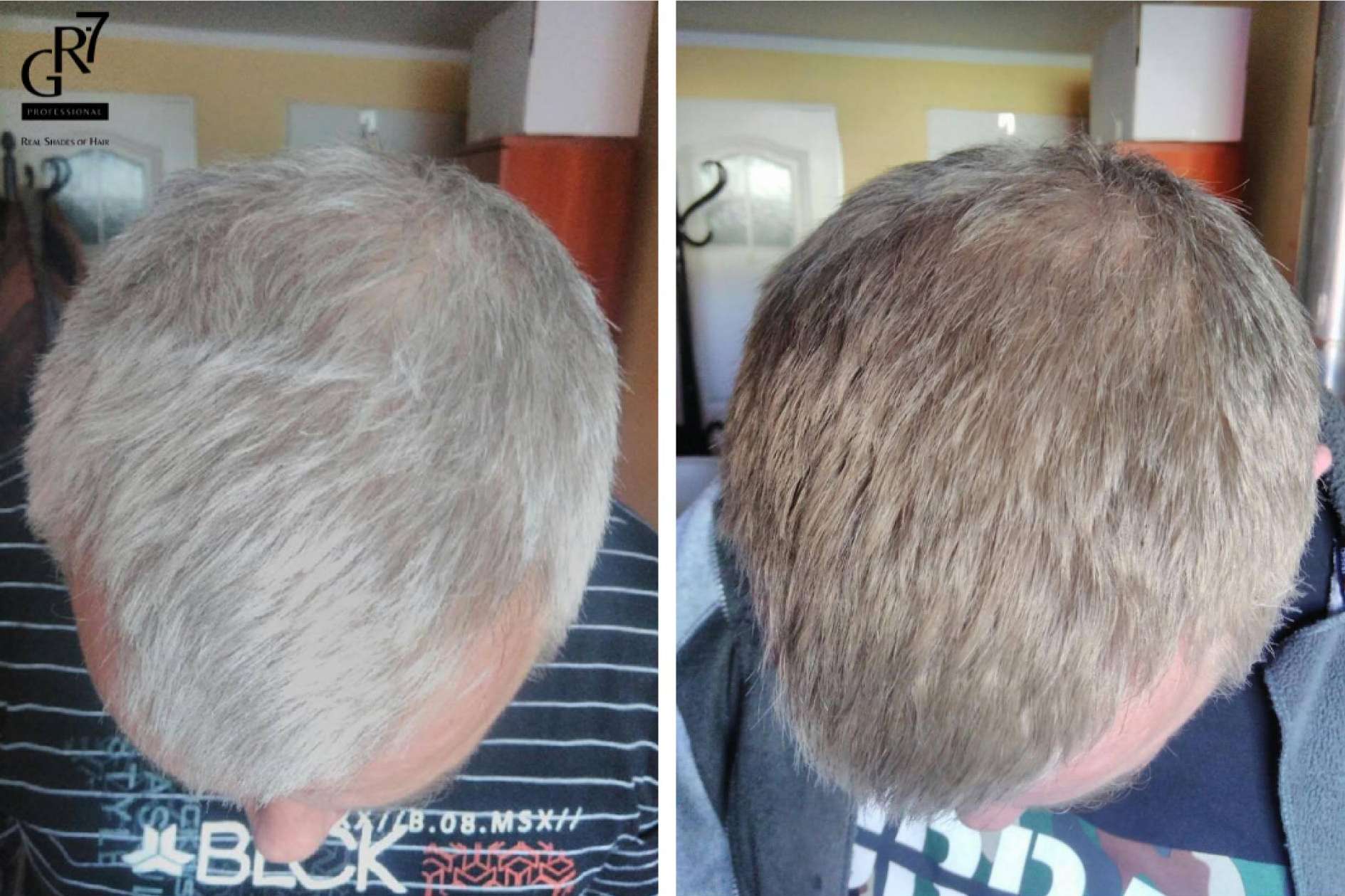 ¿Por qué motivo elegir color para las canas?