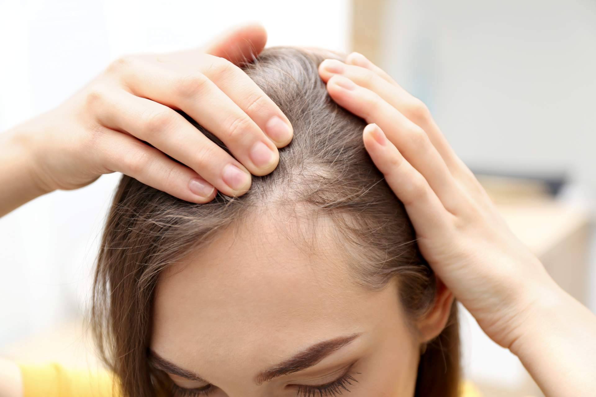 Los médicos de Capilar Innovation Clinic son especialistas en cualquier tipo de alopecia femenina