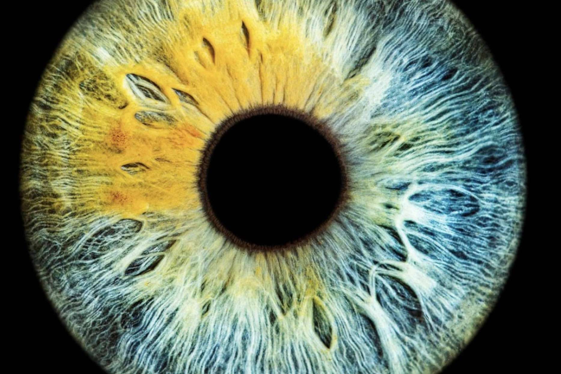 Nueva técnica fotográfica de alta definición del iris, de la mano de Eyecos
