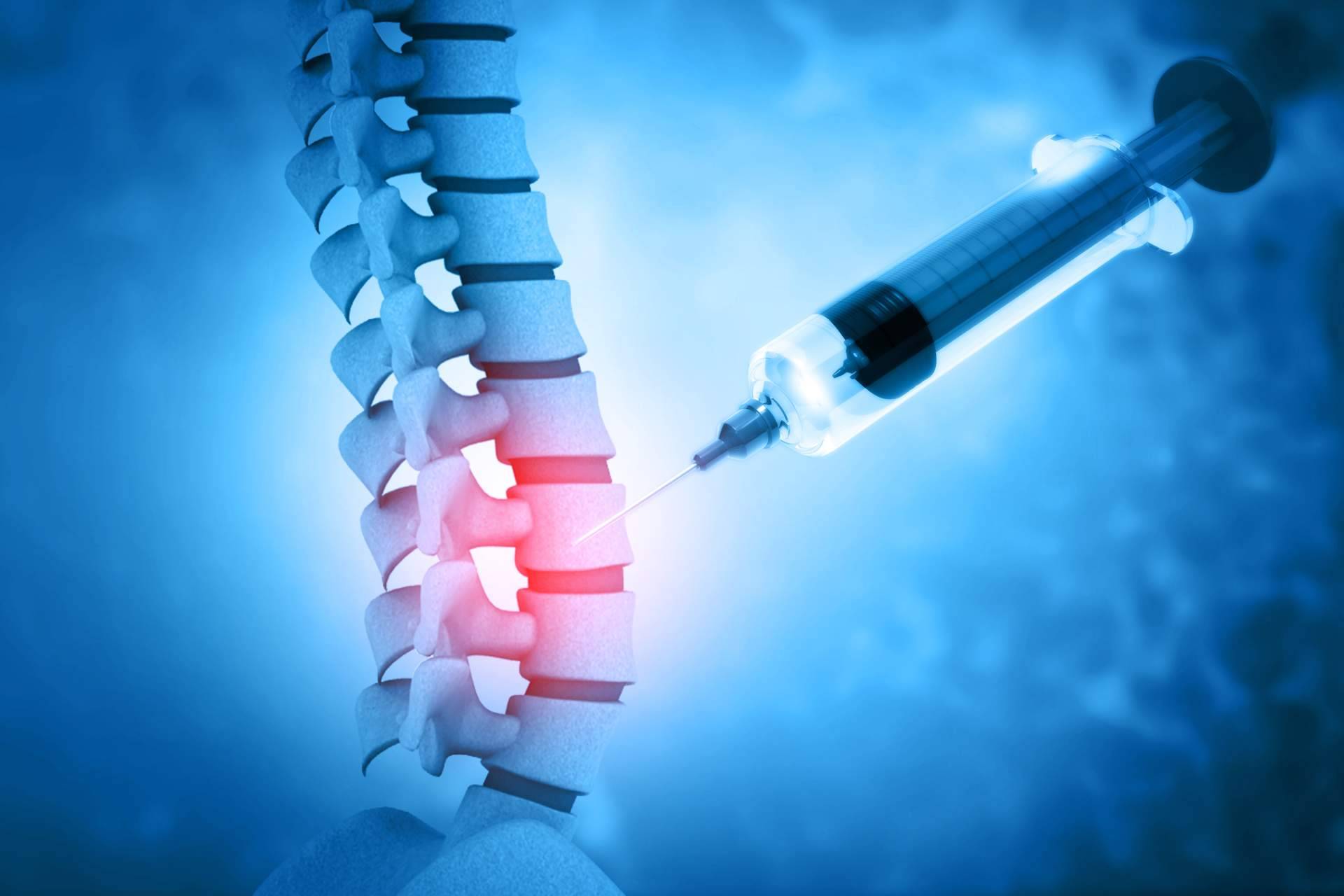 La Unidad de Columna y Traumatología de Biziondo habla del tratamiento de ozonoterapia