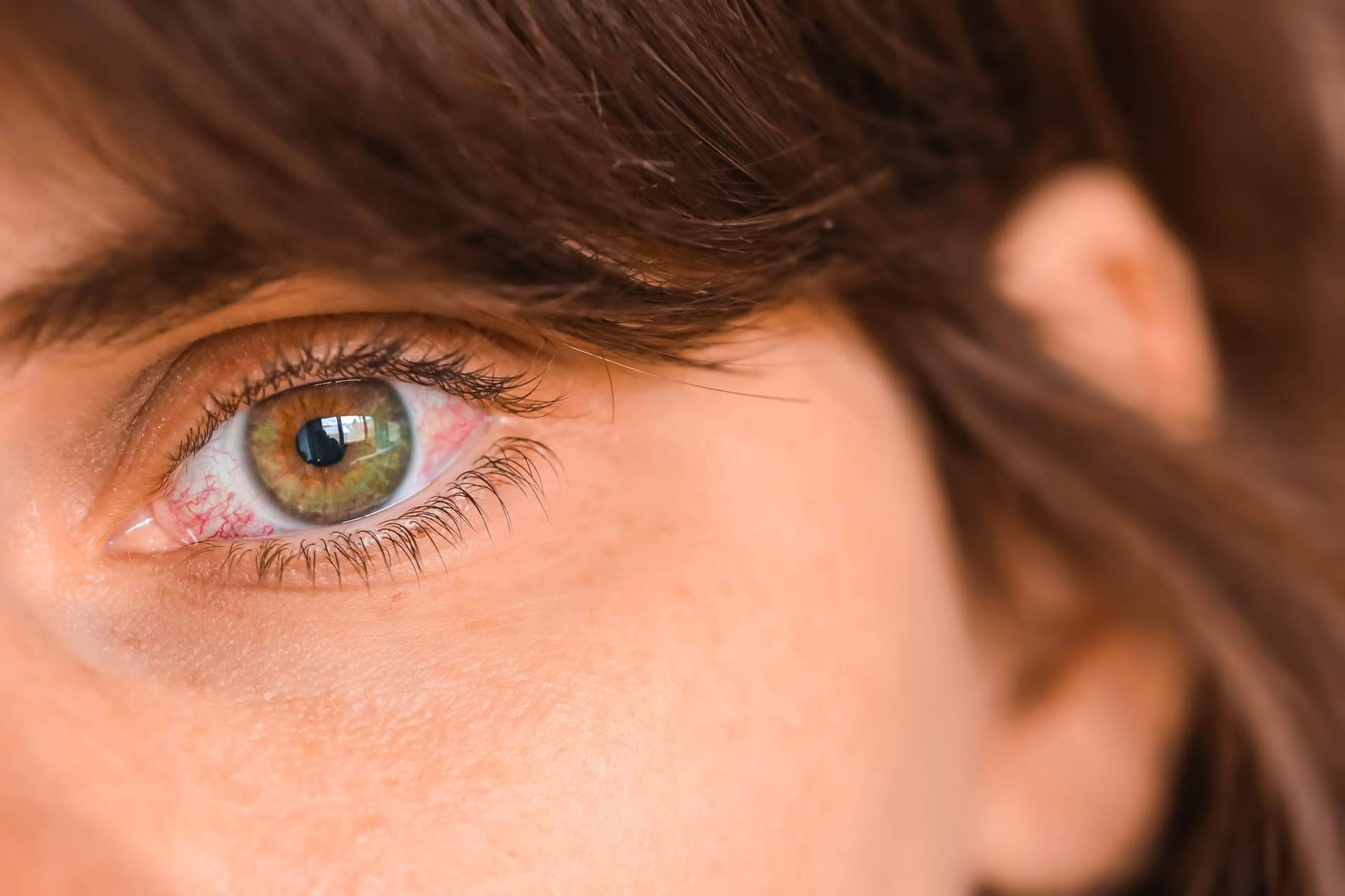 La solución perfecta para combatir el ojo seco