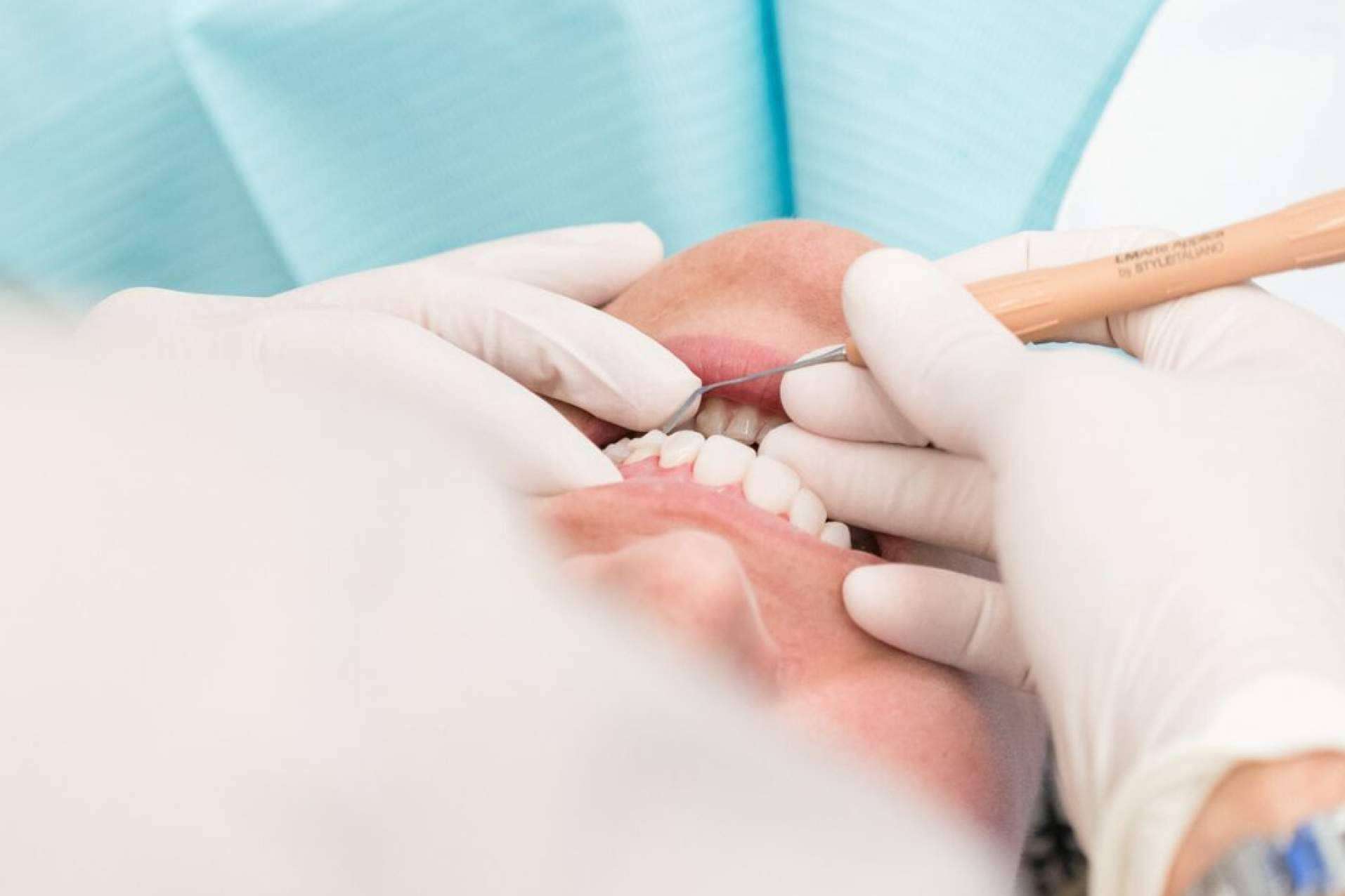 La Clínica Dental Ruiz de Gopegui explica cómo tratar la gingivitis