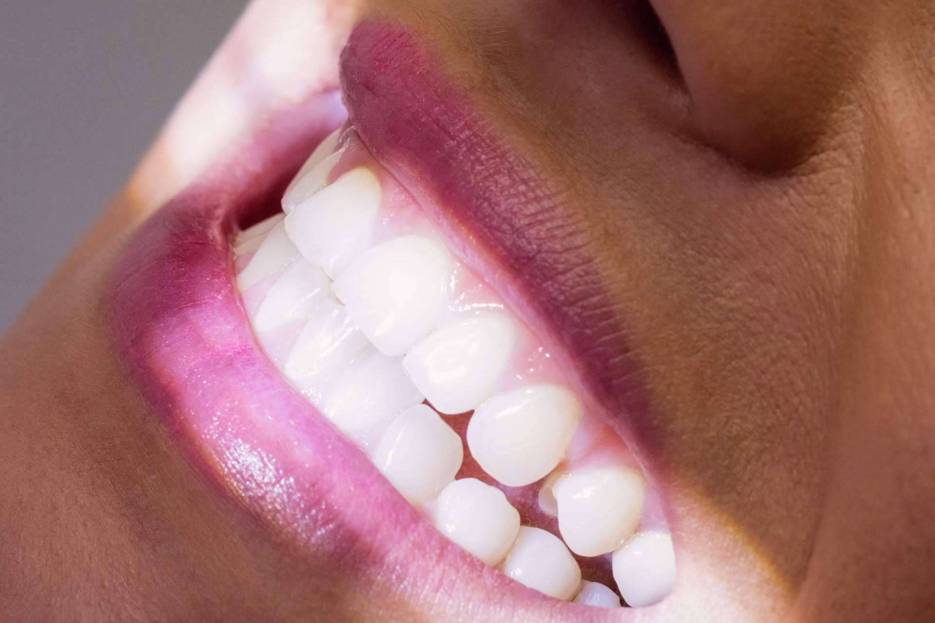 Clínica Calvo de Mora lanza promoción del 50% en blanqueamiento dental este verano 2025